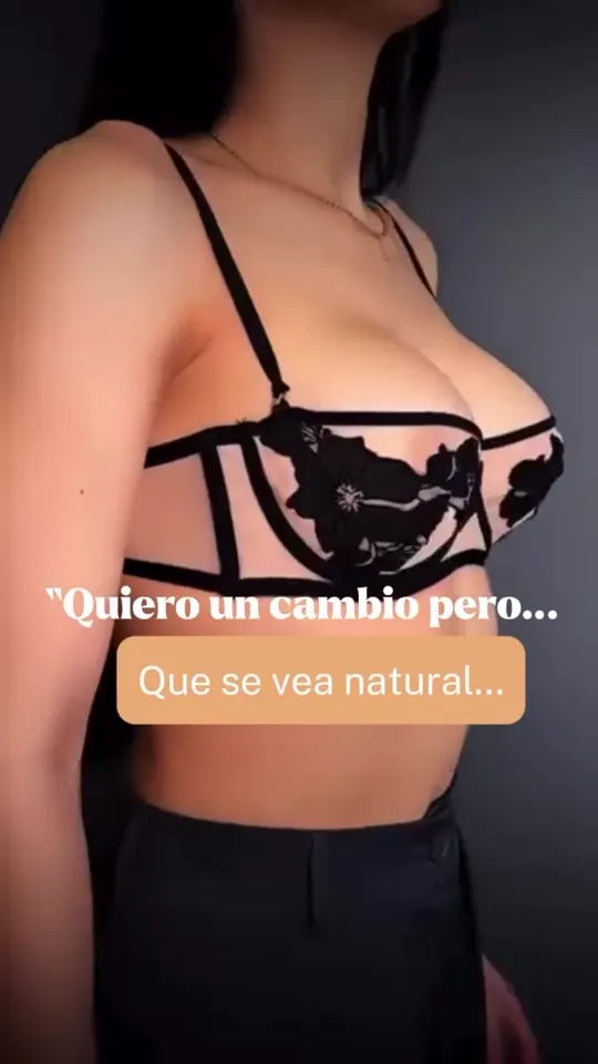 Aumento de pecho con resultado natural en Madrid