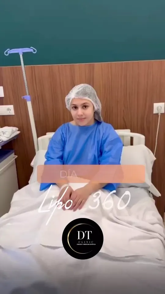 Día de cirugía de una lipo 360: testimonio de una paciente