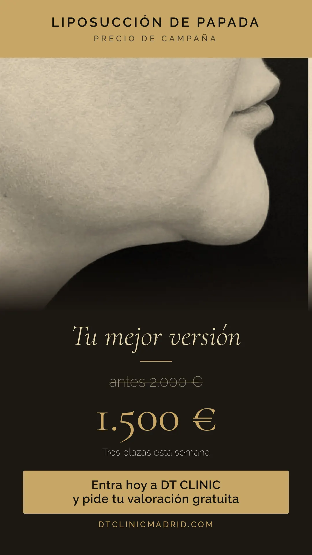 Anuncio de liposucción de papada en Madrid: 1.500 euros, antes 2.000 euros, en DT Clinic