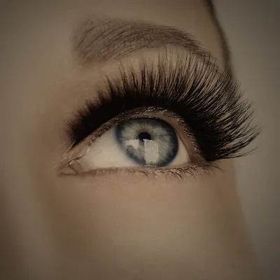 Blefaroplastia en Madrid